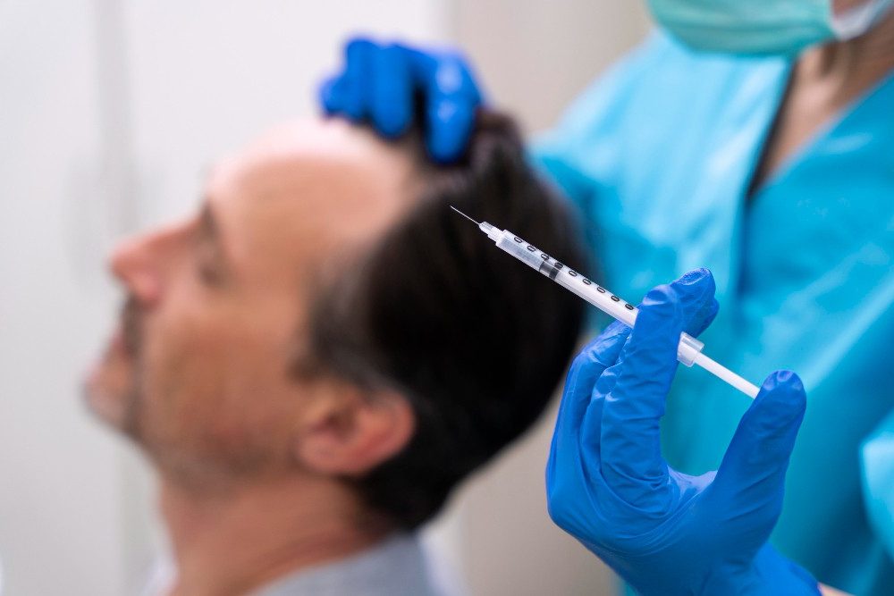 acell hair restoration near me